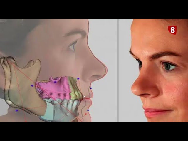 que es ortodoncia dental