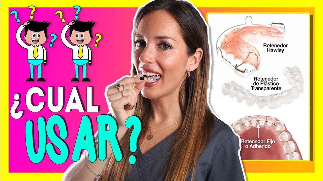retenedores ortodoncia