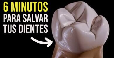 ¿Cómo detener el avance de la caries?