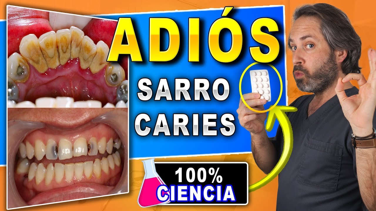 ¿Cómo eliminar las caries en los dientes?