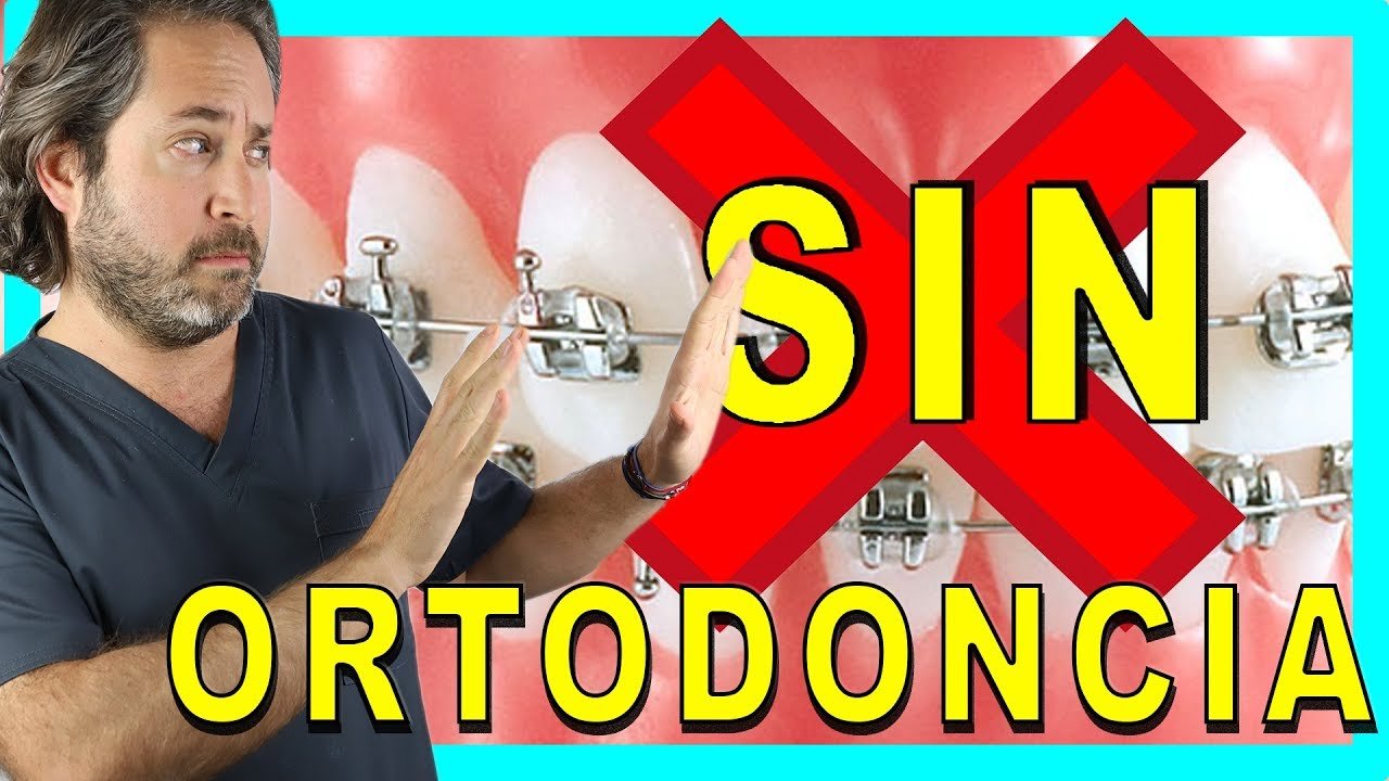 ¿Cómo enderezar los dientes chuecos de forma natural?