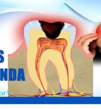 ¿Cómo saber si la caries es profunda?