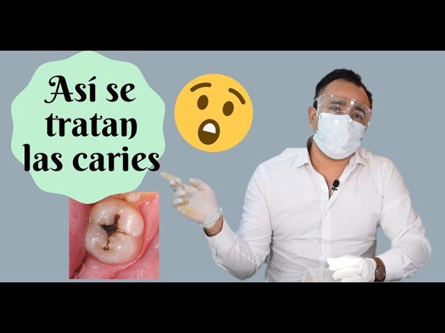 ¿Cómo se curan las caries en los dientes?
