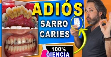 ¿Cómo se llama el tratamiento para quitar las caries?