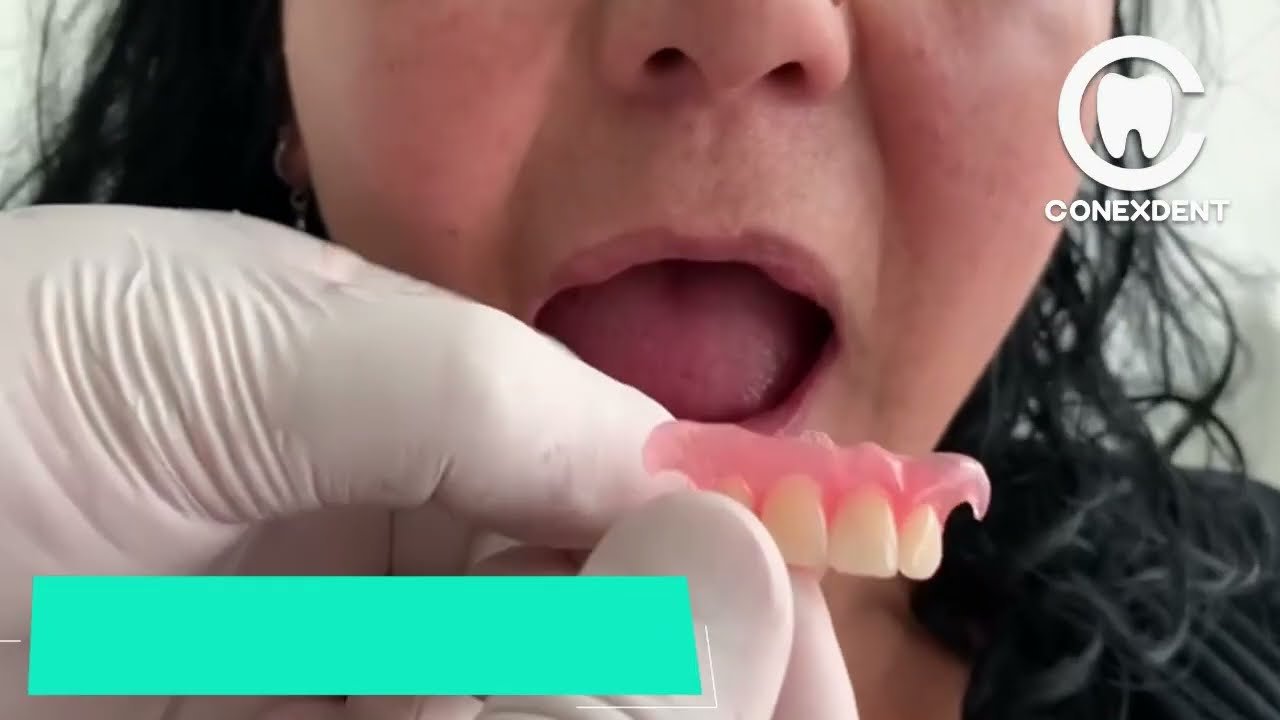 ¿Cómo se llama la persona que hace las prótesis dentales?