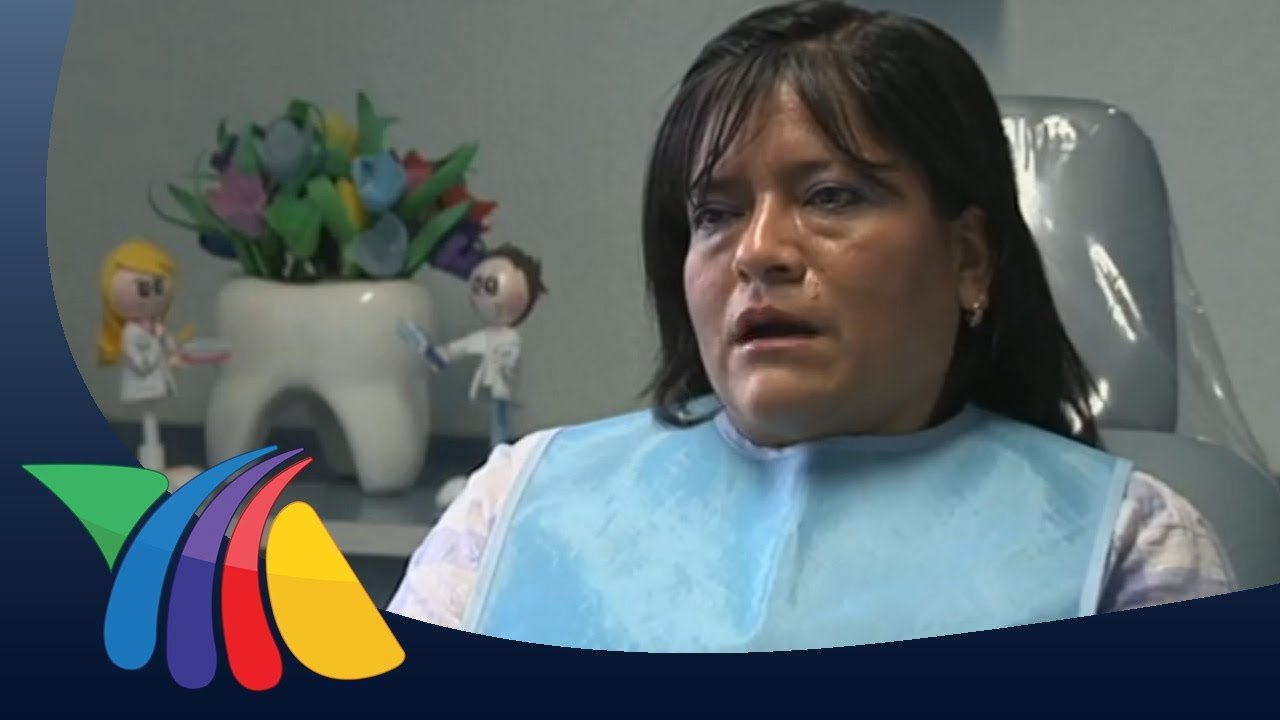 ¿Cuando una caries es preocupante?