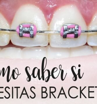 ¿Cuando una persona necesita ortodoncia?