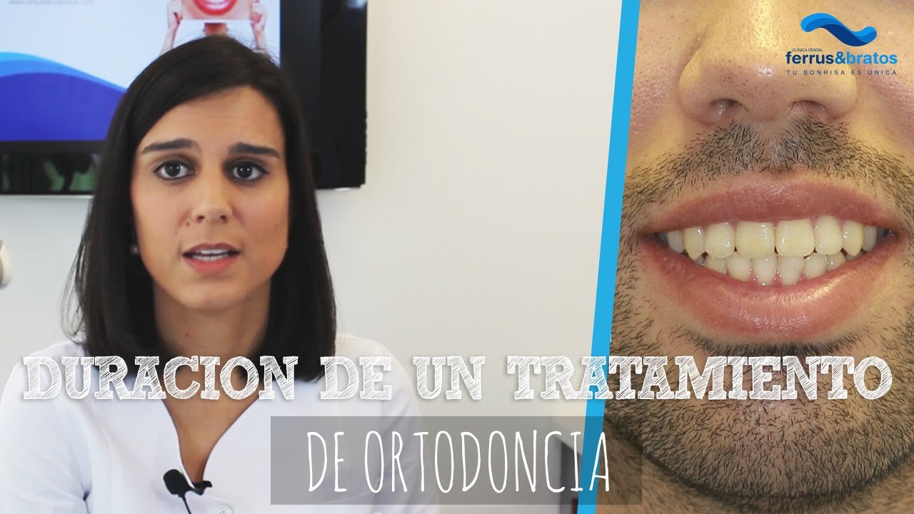 ¿Cuántas horas dura una ortodoncia?