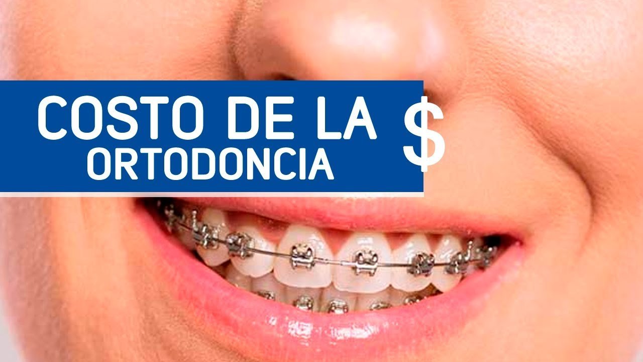 ¿Cuánto cobra un dentista por poner brackets?