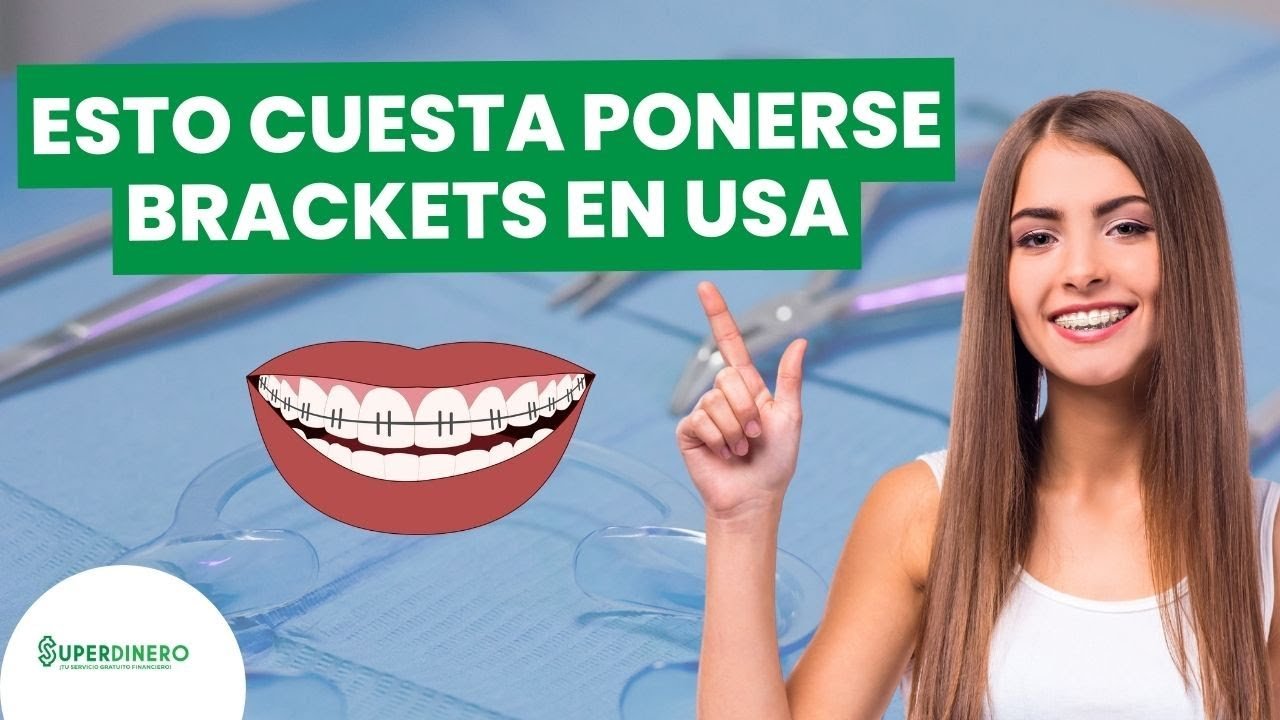 ¿Cuánto cuesta ponerse brackets en USA?