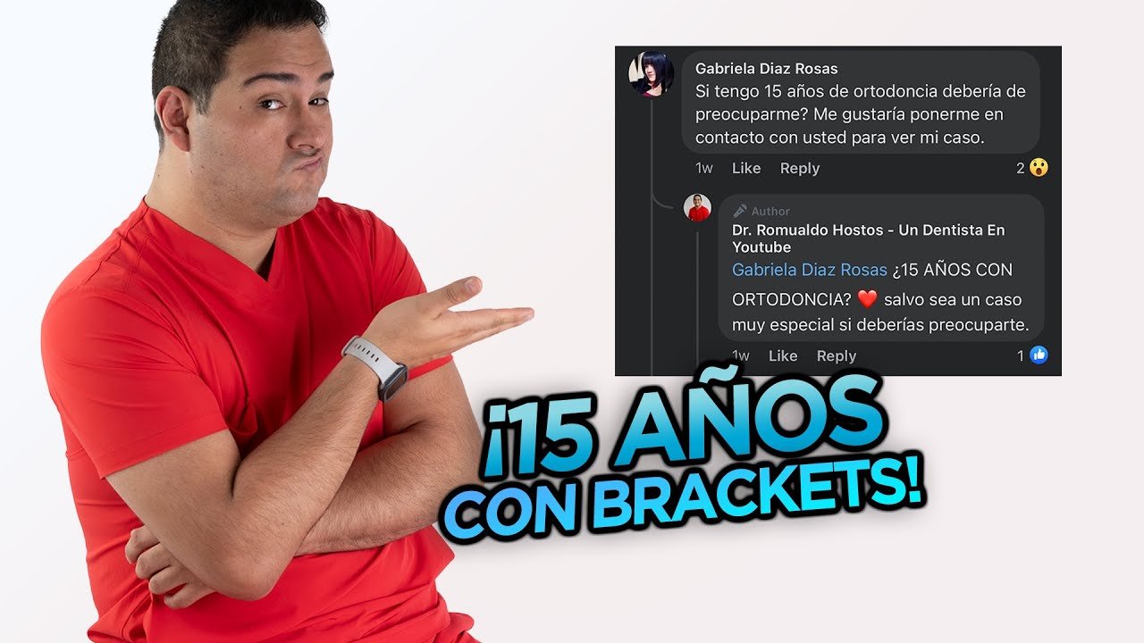 ¿Cuánto dura el tratamiento de ortodoncia?