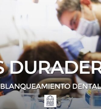 ¿Cuánto dura la estética dental?