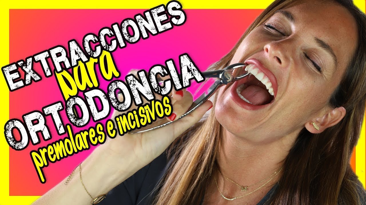 ¿Qué dientes quitan en ortodoncia?
