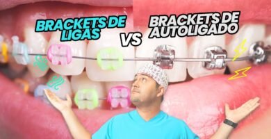 ¿Qué diferencia hay entre la ortodoncia y los brackets?