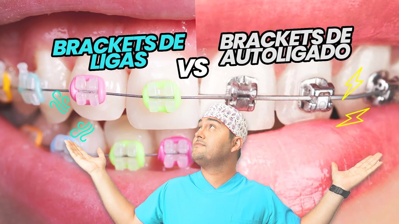 ¿Qué diferencia hay entre la ortodoncia y los brackets?