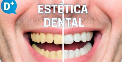 ¿Qué es la estética dental?