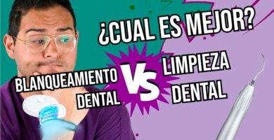¿Qué es mejor una limpieza dental o un blanqueamiento?
