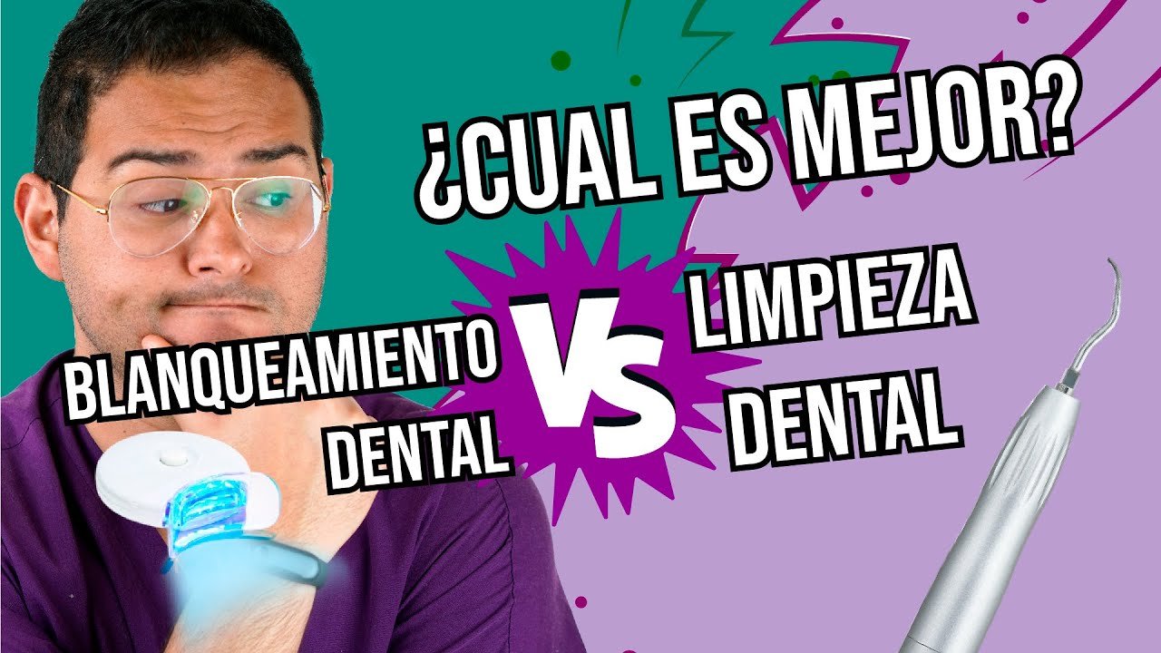 ¿Qué es mejor una limpieza dental o un blanqueamiento?