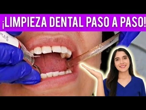 ¿Qué hace una limpieza dental?