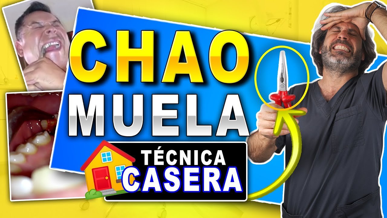 ¿Qué pasa si no me saco una muela picada?