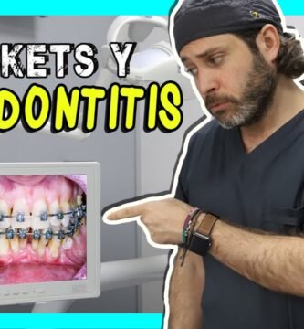 ¿Qué personas no pueden usar ortodoncia?