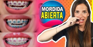 ¿Qué problemas corrige la ortodoncia?