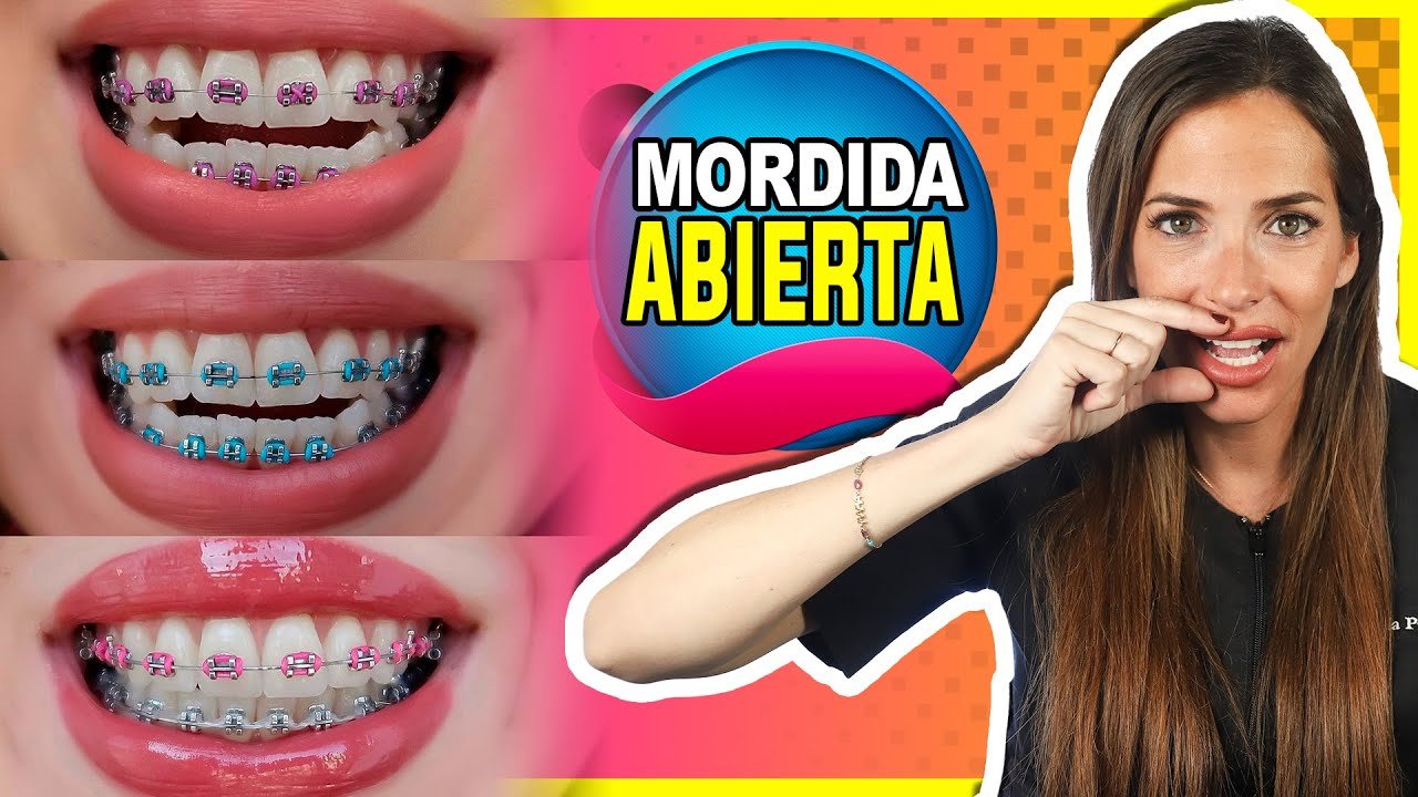 ¿Qué problemas corrige la ortodoncia?