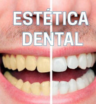 ¿Qué se hace en odontología estética?