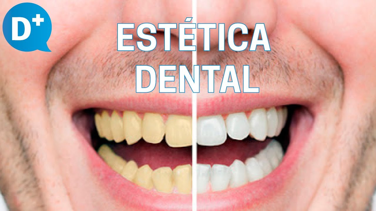 ¿Qué se hace en odontología estética?