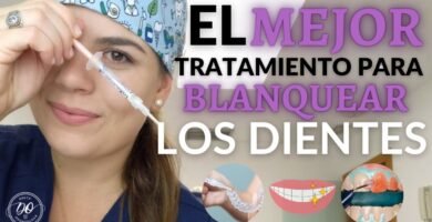 Blanqueamiento dental profesional vs casero: ¿cuál es mejor?