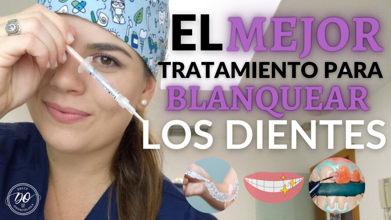 Blanqueamiento dental profesional vs casero: ¿cuál es mejor?