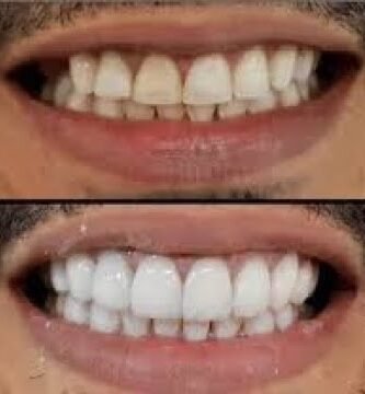 Errores comunes al cepillarte los dientes que debes evitar