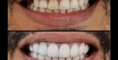 Errores comunes al cepillarte los dientes que debes evitar