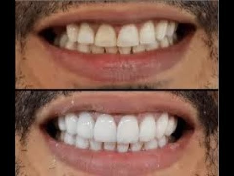 Errores comunes al cepillarte los dientes que debes evitar
