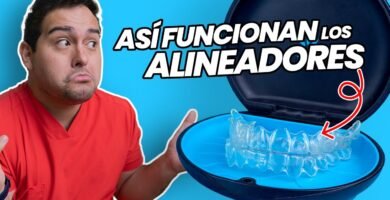 Tratamientos estéticos dentales para alinear los dientes sin brackets
