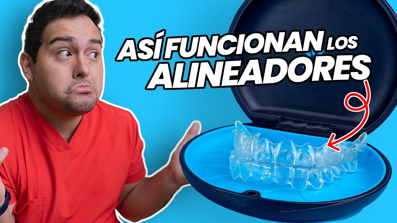 Tratamientos estéticos dentales para alinear los dientes sin brackets