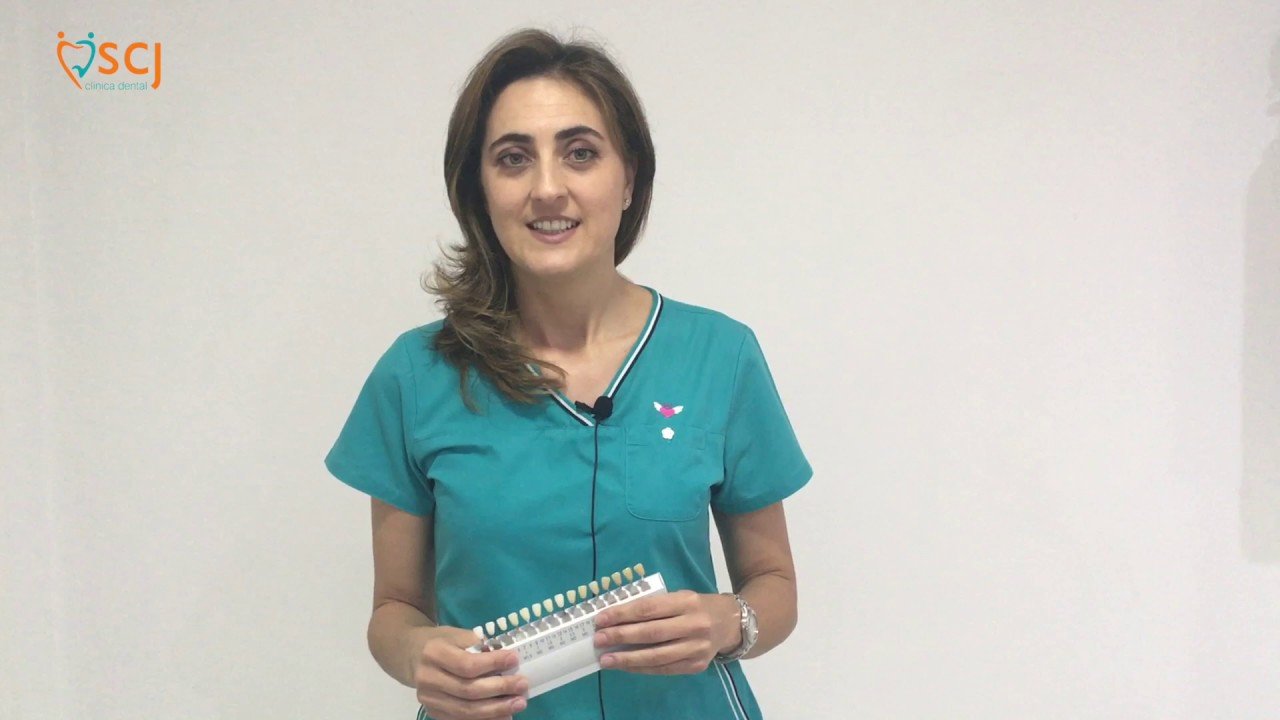 Ventajas de las carillas de porcelana en estética dental