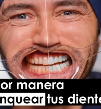 Cómo eliminar manchas en los dientes de forma natural