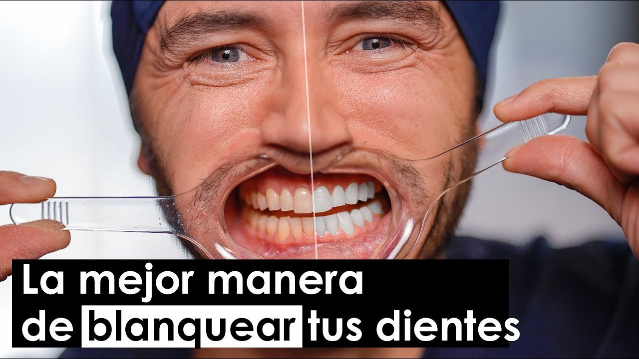 ¿Cuál es el mejor cepillo dental para mantener dientes blancos?