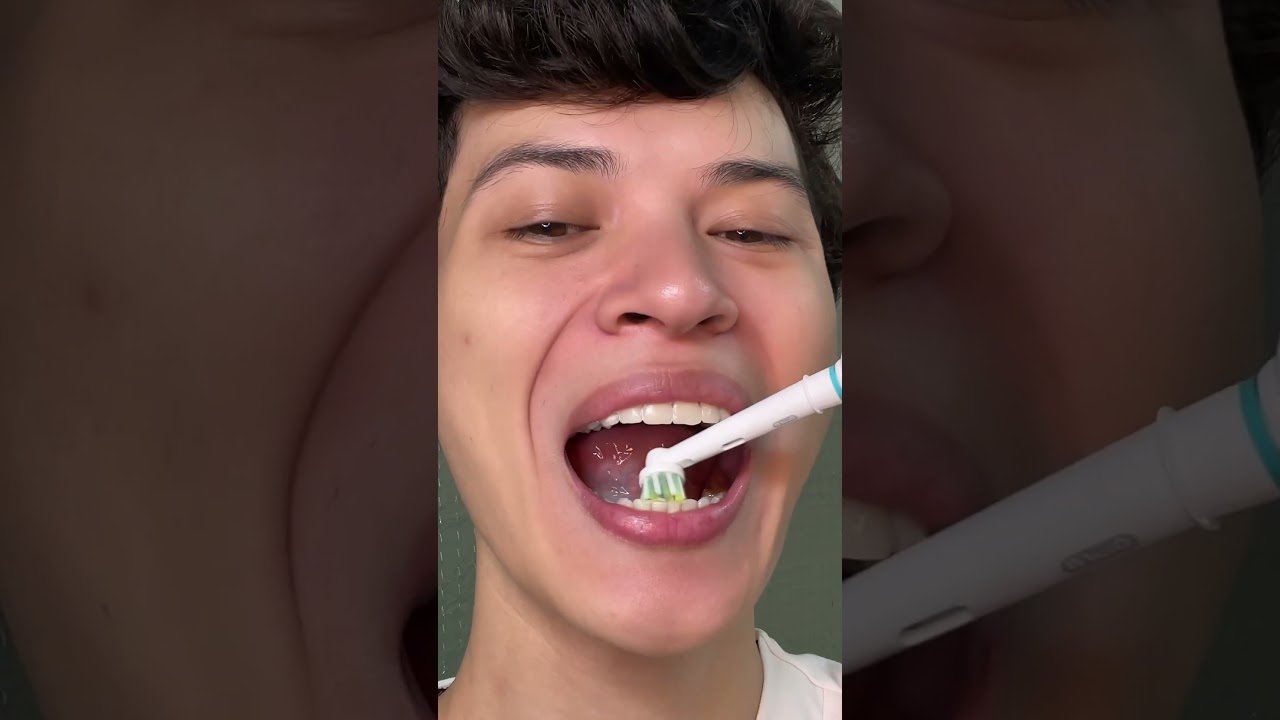 Cepillos dentales inalámbricos ecológicos: datos interesantes Lo que nadie te cuenta