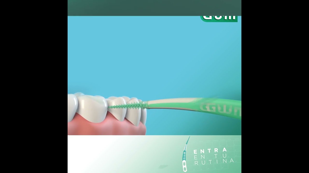 Cepillos dentales inalámbricos para personas con brackets: curiosidades Lo que nadie te cuenta