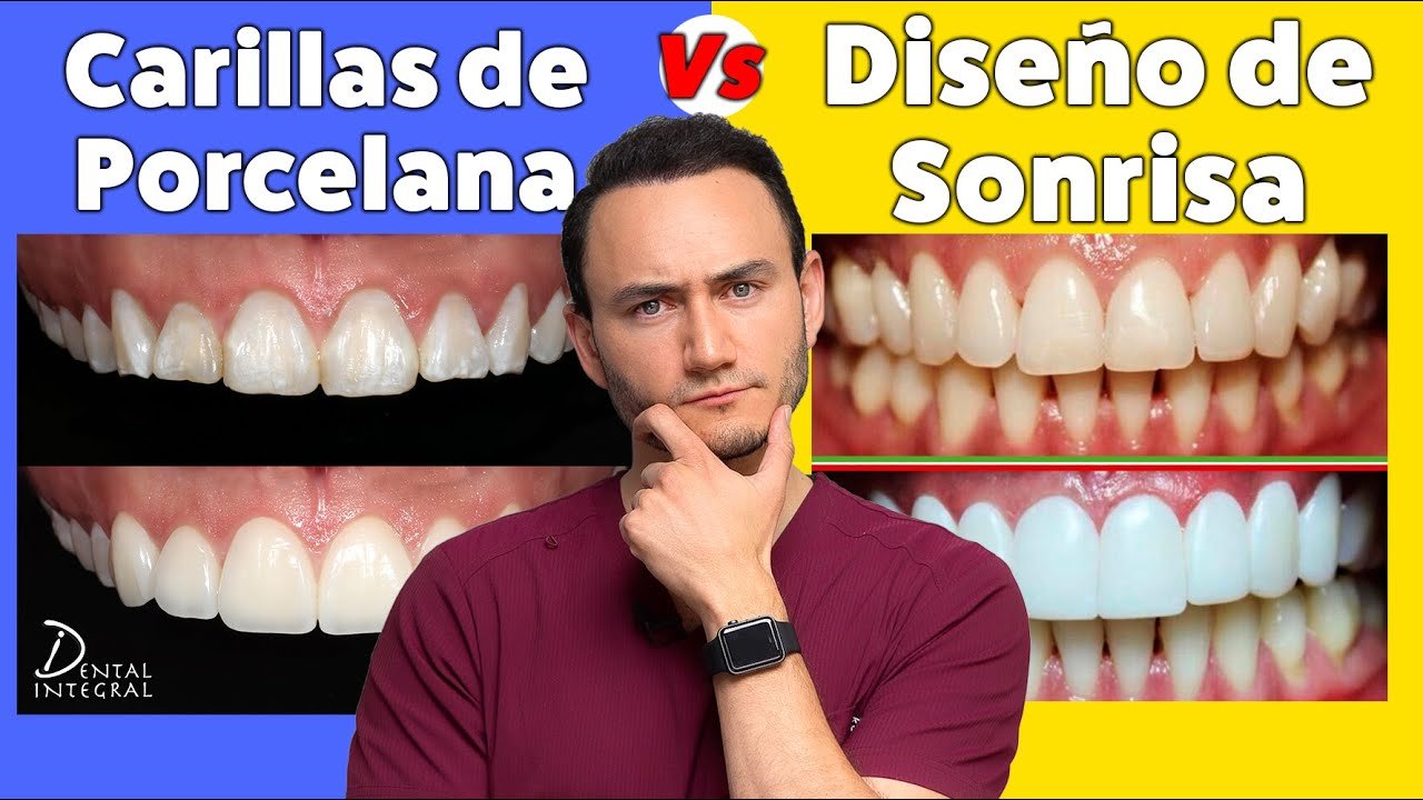 Consejos para tener una sonrisa más estética en fotos