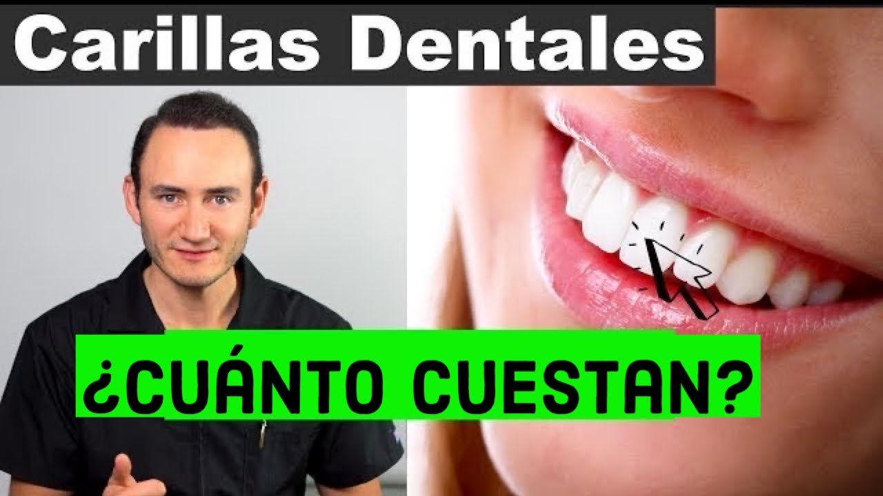 Cuánto cuesta un tratamiento de estética dental en Perú