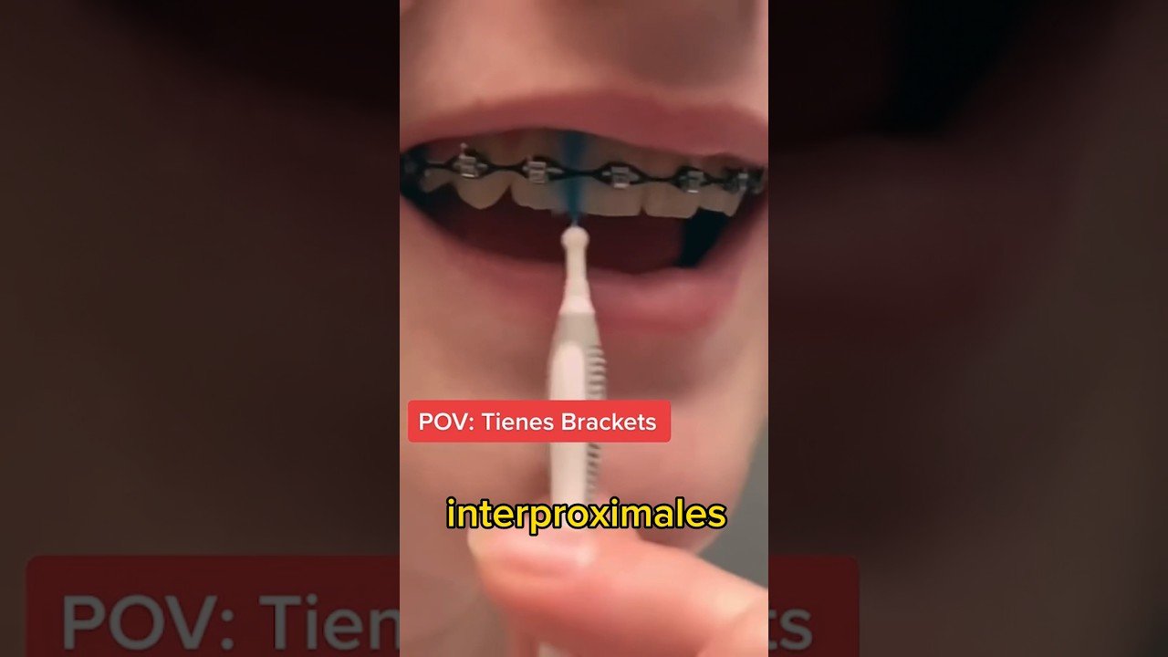 Errores comunes en la limpieza de dientes con cepillos inalámbricos Consejos útiles