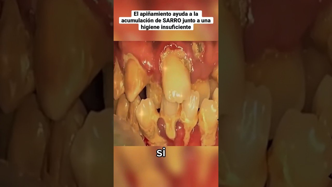 Técnicas avanzadas de limpieza dental con cepillo inalámbrico Secretos revelados