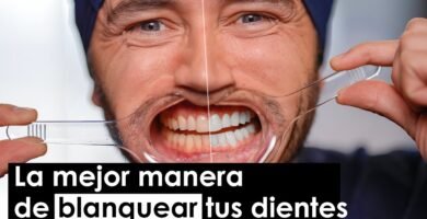 Tips para mantener una sonrisa blanca por más tiempo
