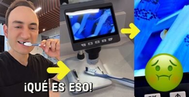 ¿Los cepillos dentales inalámbricos eliminan bacterias que causan caries? Guía completa