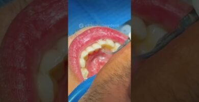 Beneficios de la limpieza dental nocturna con cepillo inalámbrico Guía paso a paso