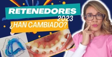 Tipos de retenedores después de la ortodoncia y su uso