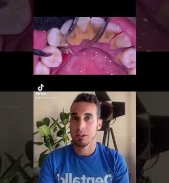 ¿Cepillos dentales inalámbricos eliminan mejor el sarro dental? Guía paso a paso